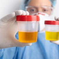 Low Urine Output? | Symptoms | Signs | Kidney failure | Medication